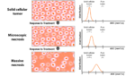 Multiparametric-mri-and-artificial-intelligence-in-predicting-and-monitoring-treatment-…-–-urotoday