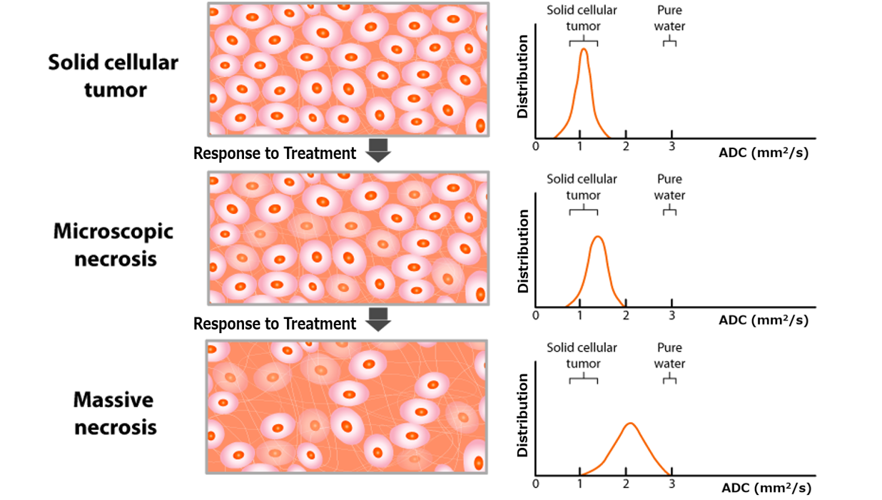 Multiparametric-mri-and-artificial-intelligence-in-predicting-and-monitoring-treatment-…-–-urotoday