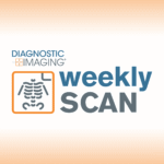 Diagnostic-imaging’s-weekly-scan:-june-22-—-june-28