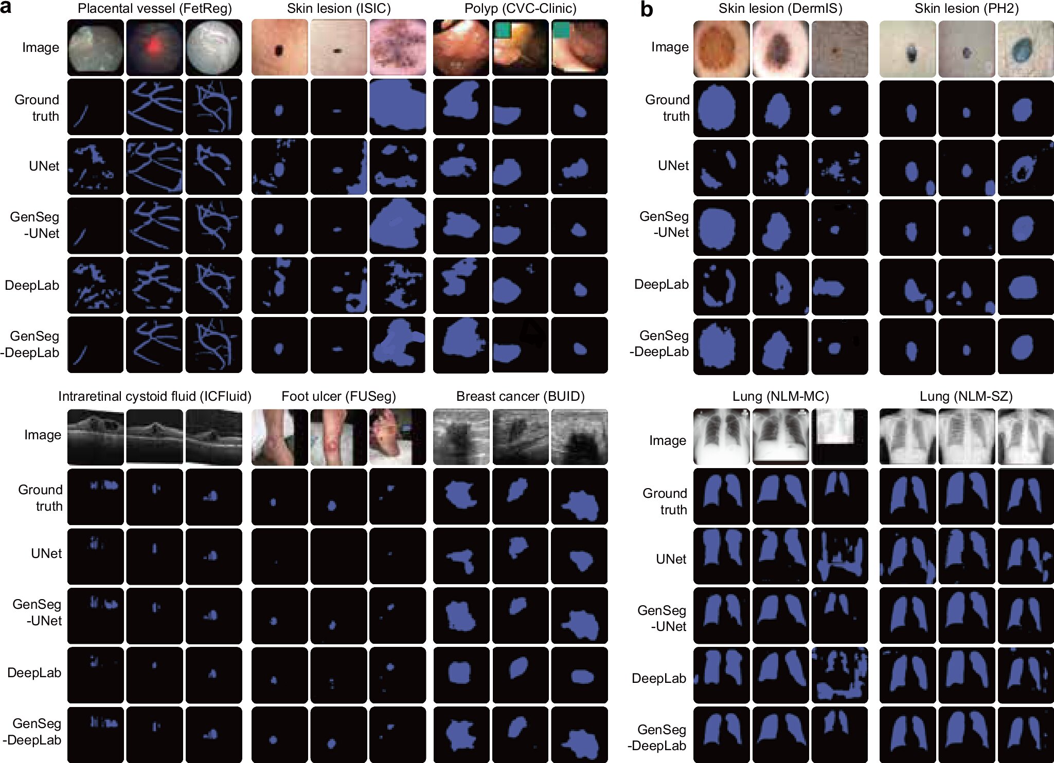 New-ai-tool-learns-to-read-medical-images-with-far-less-data