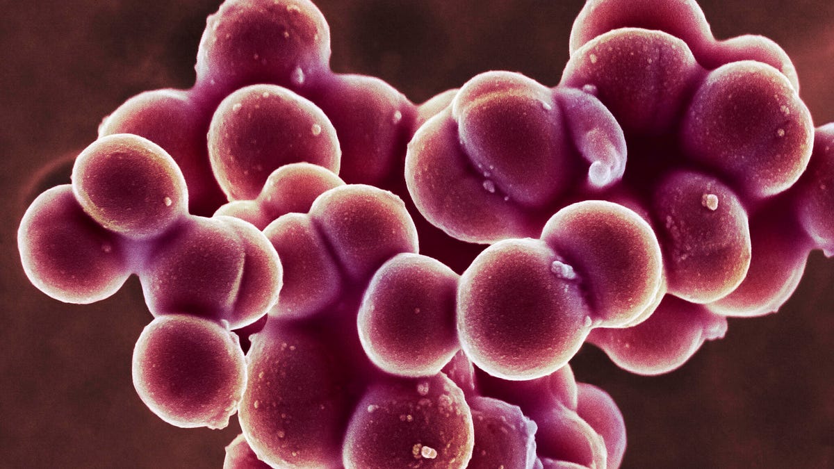 Generative-ai-gave-mit-scientists-a-new-tool-to-fight-antibiotic-resistant-bacteria-–-cnet