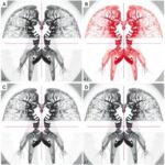 Ai-models-for-urothelial-neoplasm-classification-validated-–-bioengineer.org