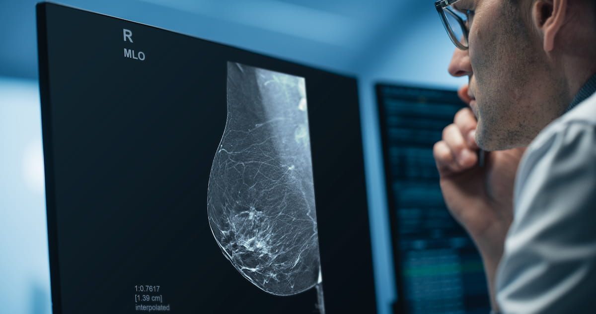 deep-learning-software-for-3d-mammography-reconstruction-gets-fda-premarket-authorization-|-diagnostic-imaging