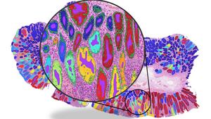 ai-cancer-tools-risk-“shortcut-learning”-rather-than-detecting-true-biology