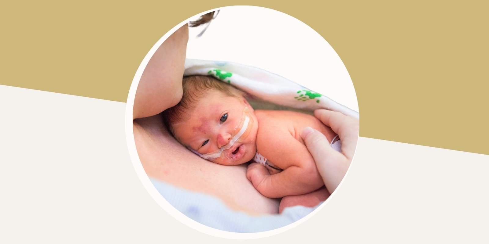 ai-analysis-of-eye-photos-may-help-detect-serious-lung-and-heart-conditions-in-premature-infants