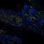 oct-powered-by-ai-based-analytics-gives-a-glimpse-into-wound-healing