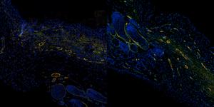 oct-powered-by-ai-based-analytics-gives-a-glimpse-into-wound-healing