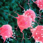 aacr-2026:-lung-cancer-immunotherapy-response-predicted-by-pathomics-ai-model