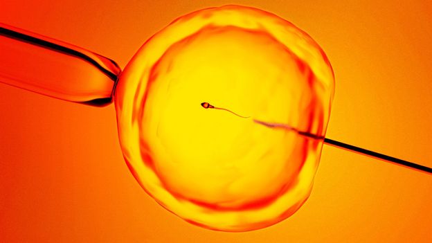 finding-‘hidden-sperm’:-new-technique-offers-hope-to-men-previously-told-they-were-infertile
