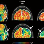 maryland’s-policy-on-ai-in-healthcare-misses-the-big-picture-|-guest-commentary