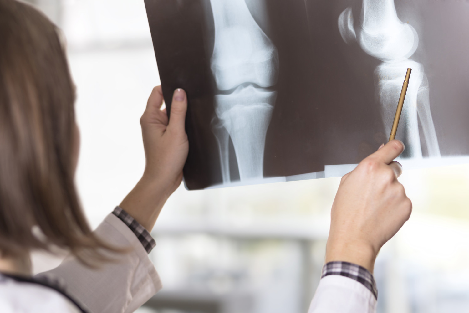 surgically-relevant-knee-phenotypes:-the-modified-coronal-plane-alignment-of-the-knee-system—a-deep-learning–based-classification