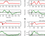 deep-learning-for-time-series-segmentation-of-mechanical-ventilator-waveforms-–-scientific-reports