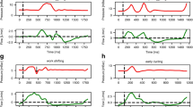 deep-learning-for-time-series-segmentation-of-mechanical-ventilator-waveforms-–-scientific-reports