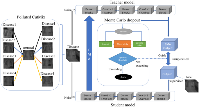 open-dataset-and-deep-learning-model-for-intelligent-diagnosis-of-neonatal-respiratory-distress-syndrome-and-aspiration-syndrome-in-newborns-–-scientific-reports