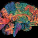 ai-maps-regional-brain-age-and-alzheimer’s-risk-–-neuroscience-news
