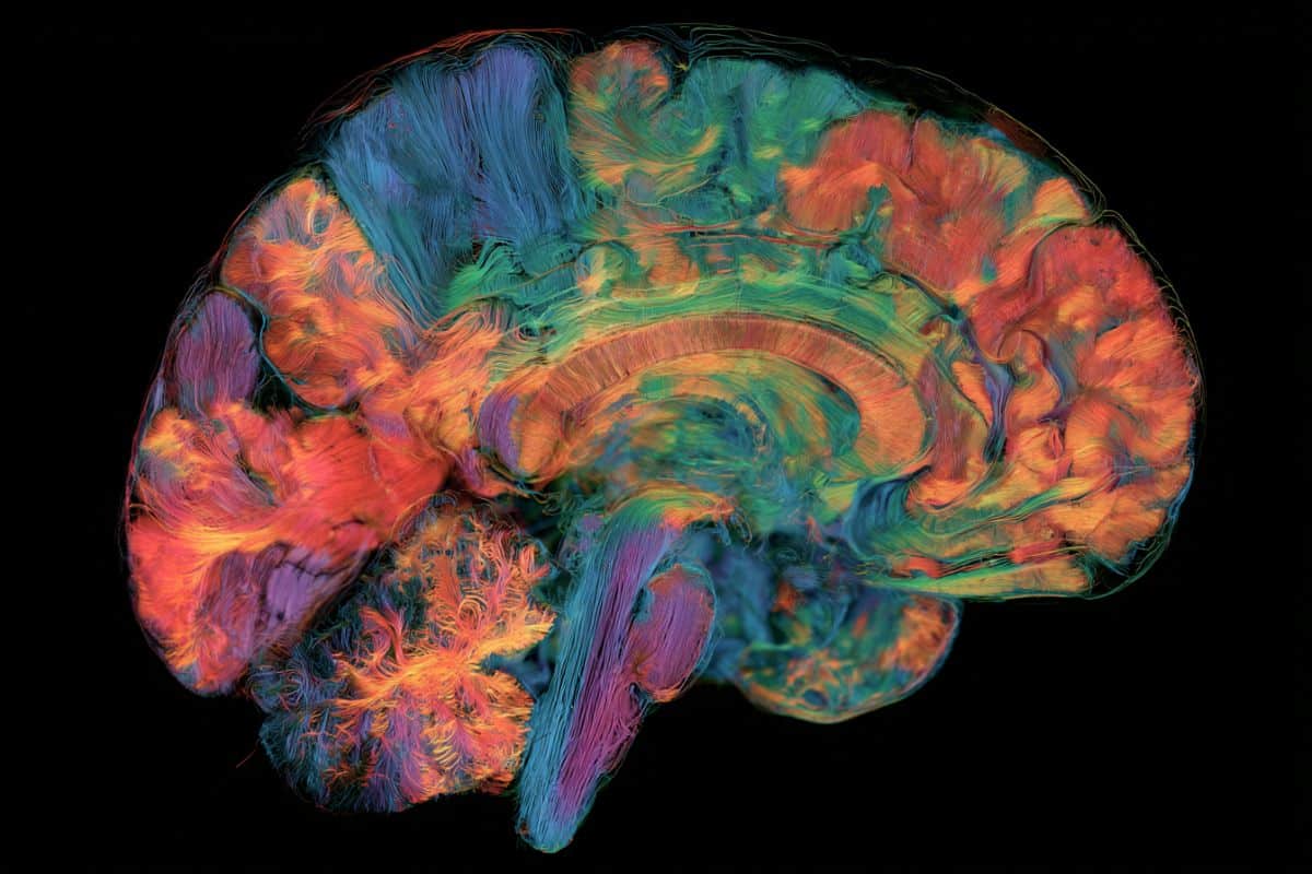 ai-maps-regional-brain-age-and-alzheimer’s-risk-–-neuroscience-news