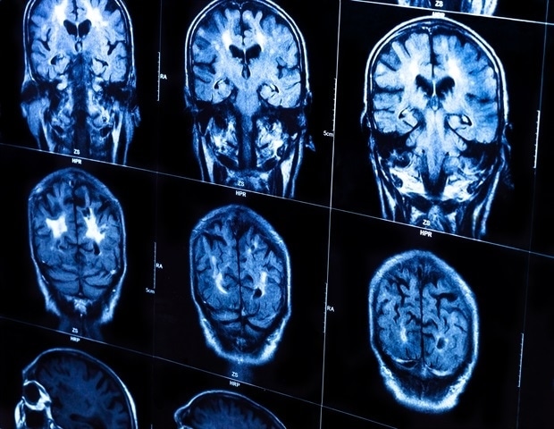 res-swinfusion-improves-anatomical-landmark-localization-with-hybrid-ai-approach