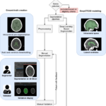 clinical-validation-pipeline-of-a-deep-learning-model-for-segmenting-and-quantifying-intracranial-and-ventricular-volumes-on-computed-tomography-–-scientific-reports