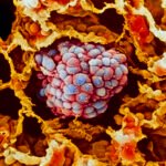 ai-tool-outperforms-pd-l1-for-predicting-lung-cancer-immunotherapy-outcomes