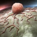 label-free-microfluidic-chip-and-ai-identify-blood-borne-tumor-cells