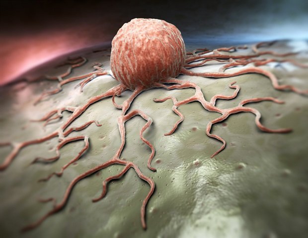 label-free-microfluidic-chip-and-ai-identify-blood-borne-tumor-cells
