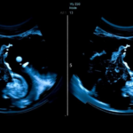 ai-that-watches-the-whole-scan:-deep-learning-reads-breast-ultrasound