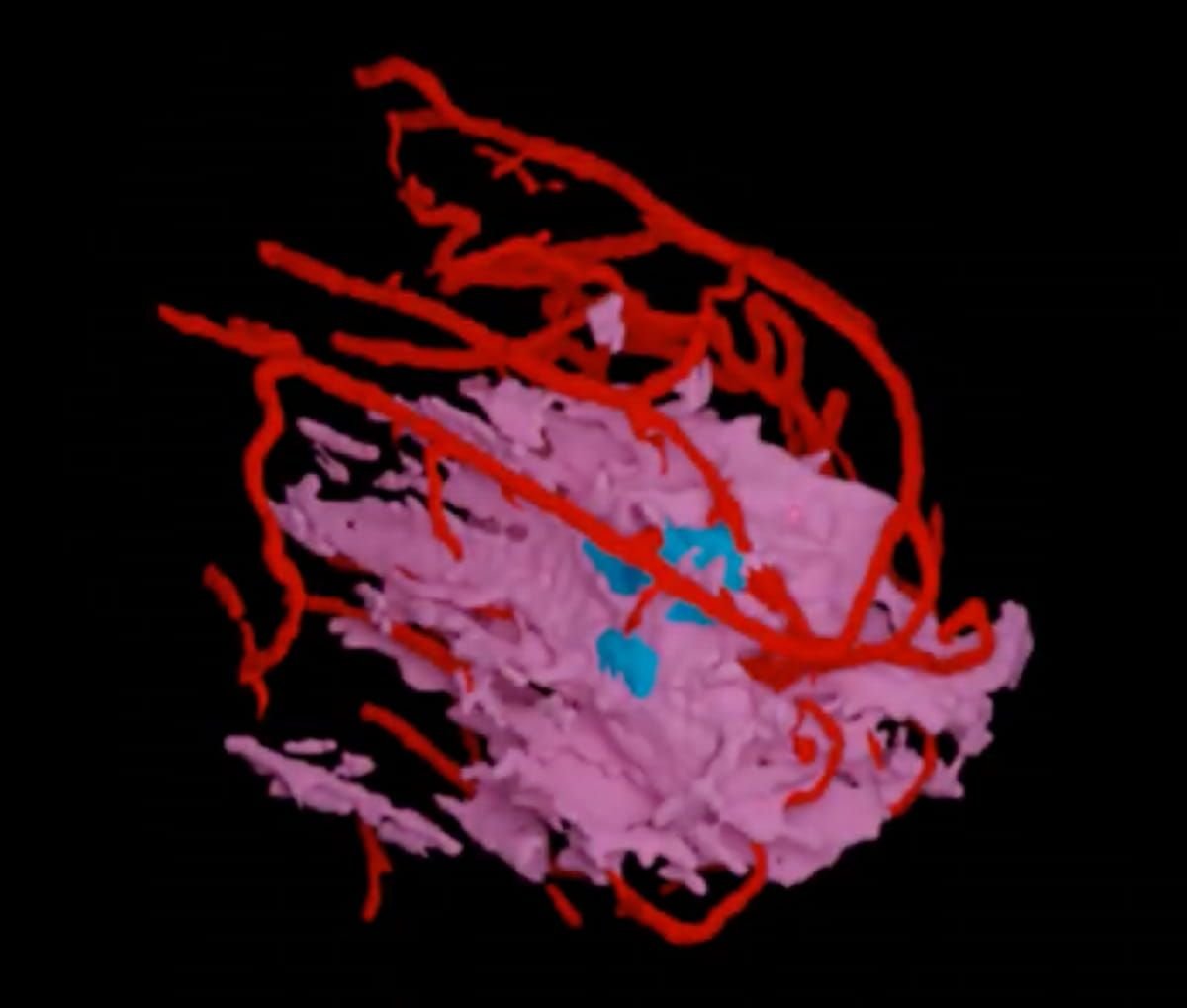 fda-clears-first-mri-derived-ai-software-for-assessing-breast-cancer-recurrence-risk-|-diagnostic-imaging