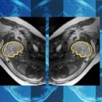 why-teaching-ai-about-symmetry-could-make-prenatal-diagnosis-more-reliable