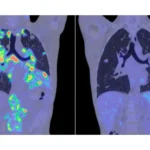 deep-learning-model-to-precisely-detect-lung-infections-|-research-matters