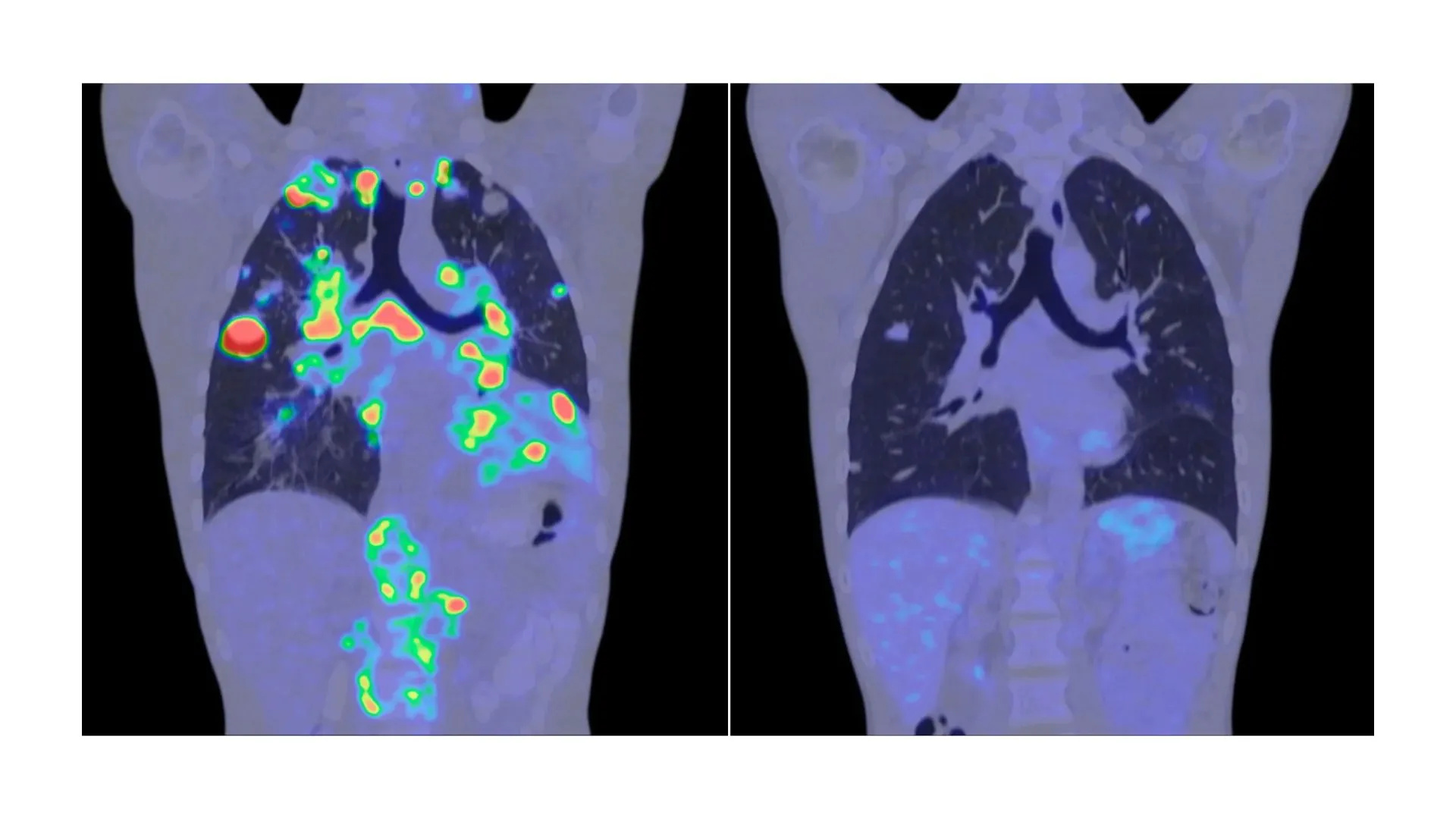 deep-learning-model-to-precisely-detect-lung-infections-|-research-matters